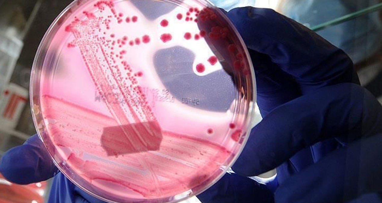 erkeklerde en cok gorulen ikinci kanser turu belli oldu 2ntKyZku