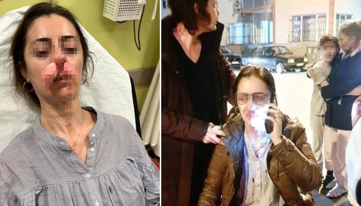 otomobil kapisi silah sayildi esinin sevgilisisandi arabanin kapisiyla saldirdi LnrV6kLC