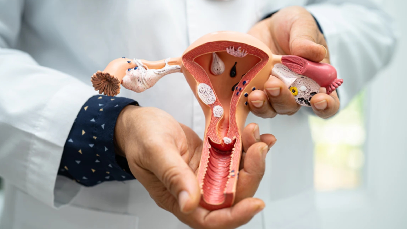 uzmani anlatti her on kadindan birinde polikistik over sendromu gorulebilir Zxzm9Bzf