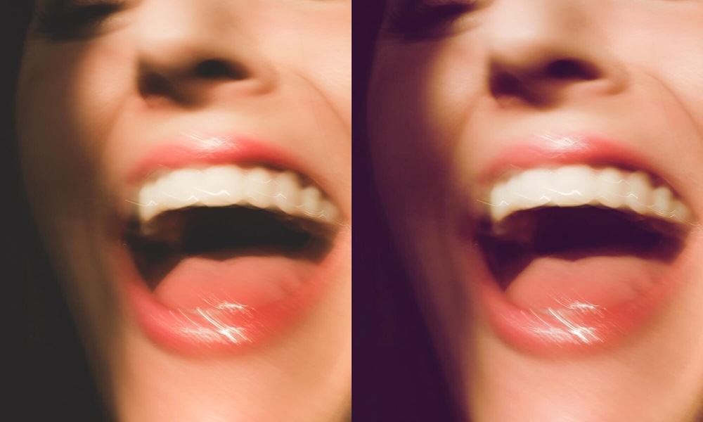 Dil Şeklimiz Lenfatik Sağlığımız Hakkında Ne Söyler?